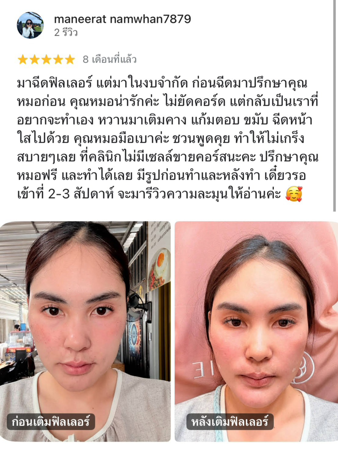 รีวิวจากผู้ใช้บริการ Rosie Clinic ภาพที่ 9